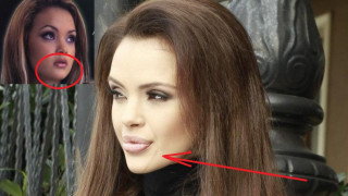 Лъснаха импланти в челюстта на Мария! (СНИМКА ОТБЛИЗО)