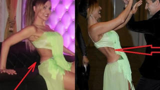 Глория пръснала $25 000, за да я обезобразят (Още снимки на изваденото ребро)