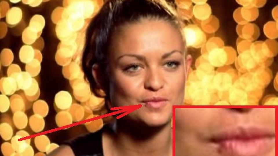 Фенове притеснени: Кой разби устата на Яна от Dancing stars? (СНИМКИ)