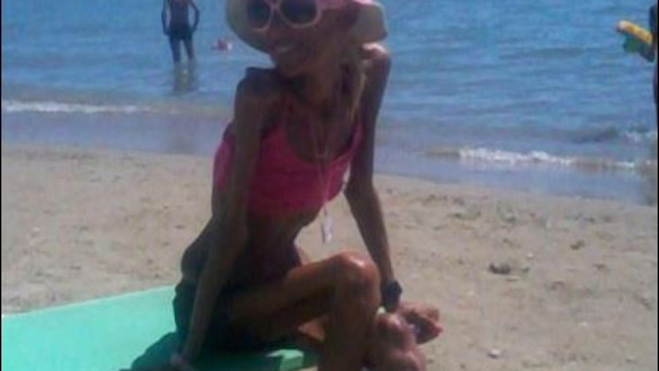 Гръцка водеща всява смут на плажа с анорексията си (СНИМКИ) 
