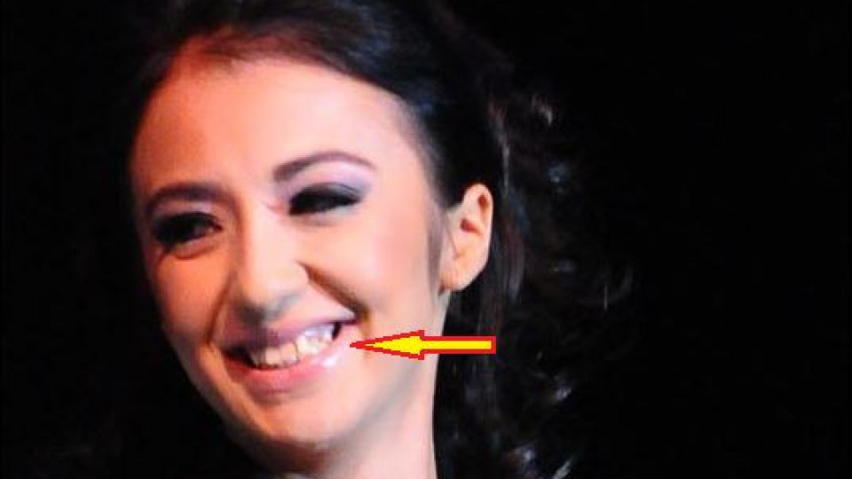 Ани Хоанг с избити зъби на участие