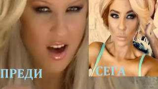 Андреа лъже за пластиките по лицето - вижте ги всички