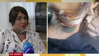 Марешка Глущук нападната с нож? (Раната на 2 мм от сънната артерия, моделката на косъм от смъртта)