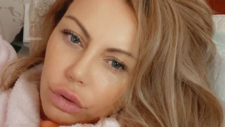Камелия неузнаваема! (Певицата окепази и устните си с хиалурон – Снимки)