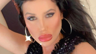Радинела Чушева втрещи с изпилен нос (Миската тотално се окепази с поредната пластика – Фото)