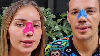 Алекс и Дани Петканови гушнали 15 бона за ринопластиката (Вижте как се продадоха)
