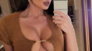 Николета Лозанова тъне в ултра лукс в турска клиника (Моделката си оперира Д-то за 7000 евро - Снимки)