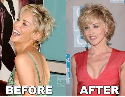 Чаровната актриса преди и след пластичните операции