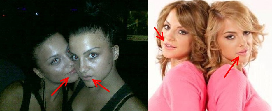 Близначките от Мис България преди и след тунинга