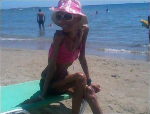 Гръцката водеща Нана Карагиани всява смут на плажа с анорексията си