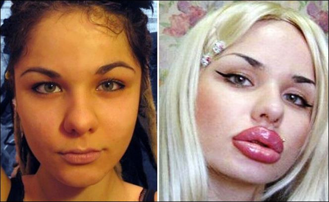 Кристина Рей преди и след като се сдоби с най-големите устни в света 