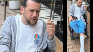 Веселин Плачков: Не са ме пребили мутри, пострадах при много идиотска случка