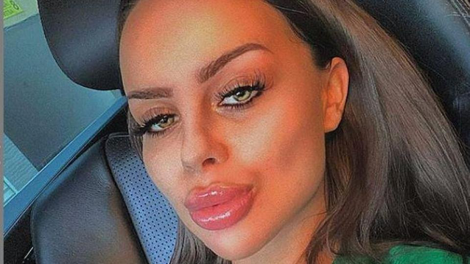 Силиконовата мания на Сузанита я вкара в клиника под пълна упойка